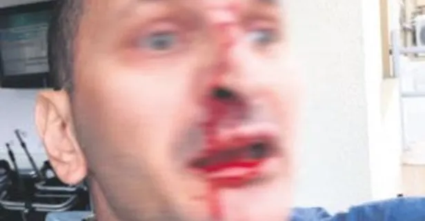 Doktora Siddet Bitmiyor Hasta Yakini Doktora Kafa Atti Takvim