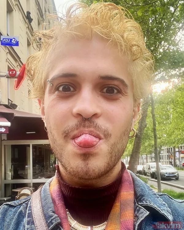 2016 O Ses Türkiye'nin şampiyonu Emre Sertkaya’nın son hali ağızları açık bıraktı! Gören tanıyamadı: Abi niye böyle oldun? - 19