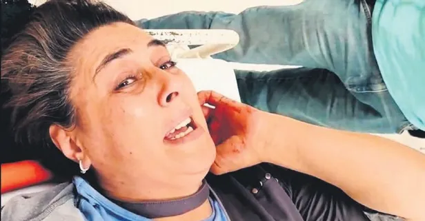 Eşini bıçakladı serbest kaldı!