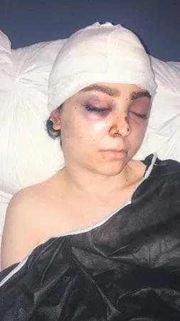 girdigi-denizde-kaybolan-mustafa-cobanoglunun-cesedi-7-ay-sonra-yunan-adasi-bulamacta-bulundu-1645745434582.jpeg Girdiği denizde kaybolan Mustafa Çobanoğlu'nun cesedi 7 ay sonra Yunan adası Bulamaç'ta bulundu-6