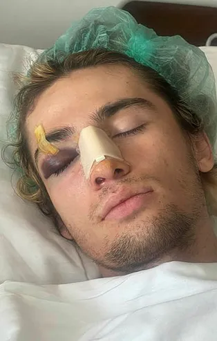 Milli sporcuya öldüresiye dayak! Kaykayla suratına vurdular