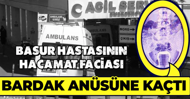 Şanlıurfa’da basur hastasının hacamat kazası! Yağlı çay bardağı anüsüne kaçtı
