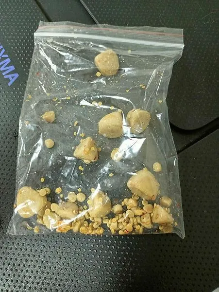 kopegin-mesanesinden-cikanlar-soke-etti-tam-55-parca-1664793781655.jpeg Köpeğin mesanesinden çıkanlar şoke etti! Tam 55 parça-3