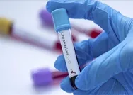 Koronavirüs Kovid-19 can almaya devam ediyor! Korkunç salgında bilanço yükseldi