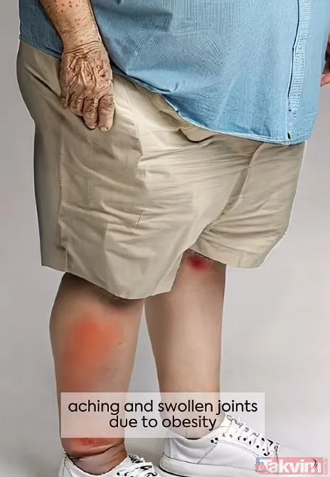 Haftada İki Porsiyon Balık Tüketin, Bunlardan Biri Yağlı Balık Olmalı. Lif Alımını Artırarak Sindirim Sisteminizi Destekleyin. Şeker Ve Doymuş Yağ Tüketimini...