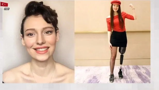 Kanserle mücadelenin sembol ismi Neslican Tay yoğun bakımda! Tedavi gördüğü hasteneden son dakika Neslican Tay açıklaması