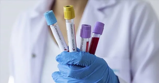 Dünyada koronavirüs vaka sayısı 1,5 milyonu aştı