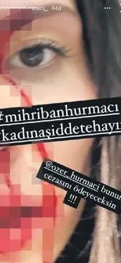 Eski futbolcu Özer Hurmacı eşi Mihriban Hurmacı'yı öldüresiye dövdü! "Sen tam bir canavarsın"-3