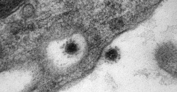 Rusya’da koronavirüsün Delta Plus mutasyonu görüntülendi! İşte o fotoğraflar...