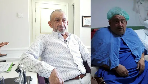 ameliyatla-200-kilodan-84-kiloya-dustu-1603373339701.jpg Ameliyatla 200 kilodan 84 kiloya düştü-2