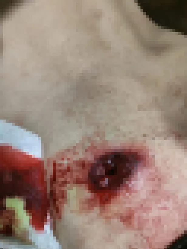 yunan-polisi-gocmenleri-plastik-mermilerle-yaraladi-1653548681306.jpg Yunan polisi göçmenleri plastik mermilerle yaraladı!-1