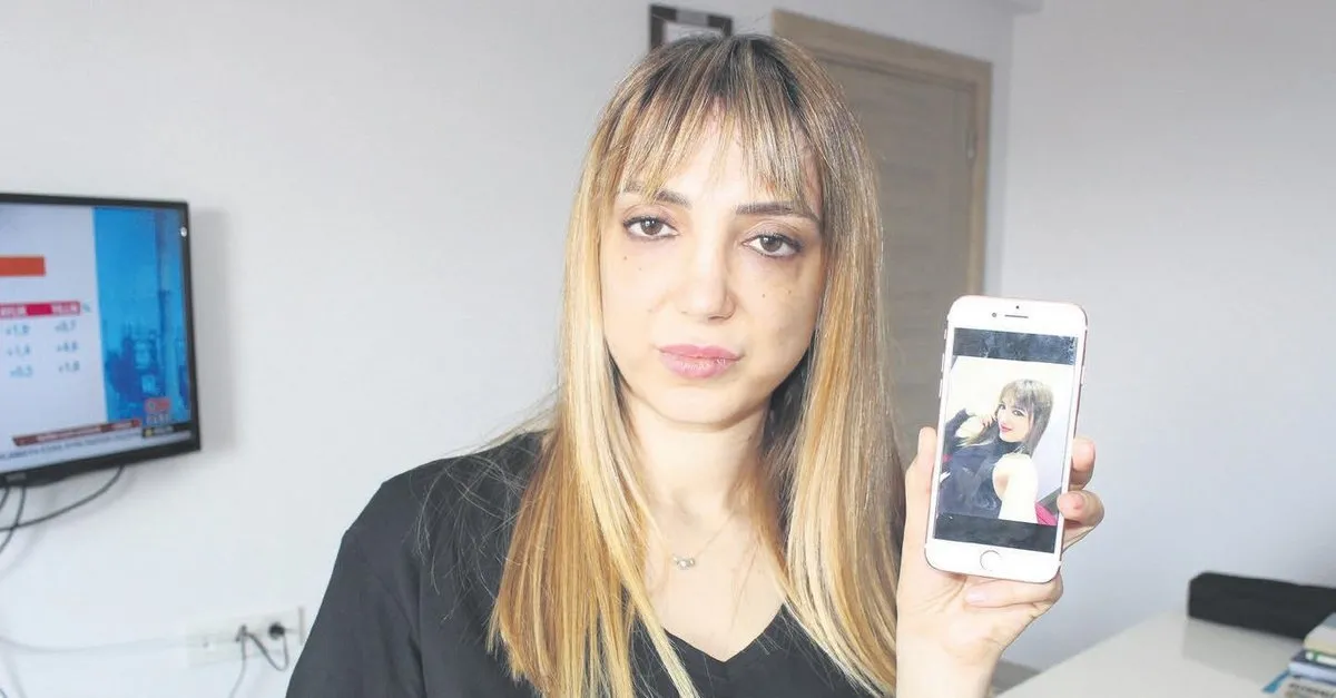 Badem Goz Estetigi Yaptirmak Istedi Yuzu Taninmaz Hale Geldi Takvim