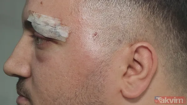 Eyüpsultan'da "yol verme" kavgası! Önce darbetti sonra tanımazlıktan geldi: Buyur kardeşim - 3