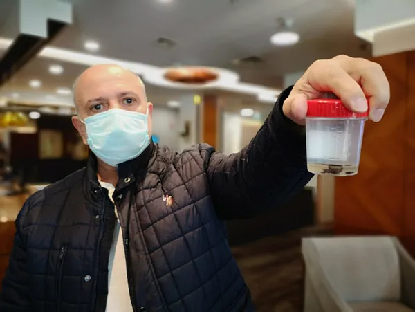 kanser-suphesiyle-doktor-doktor-gezdi-akcigerinden-32-yil-sonra-cam-fistigi-cikarildi-1610781613002.jpg Kanser şüphesiyle doktor doktor gezdi! Akciğerinden 32 yıl sonra çam fıstığı çıkarıldı-6