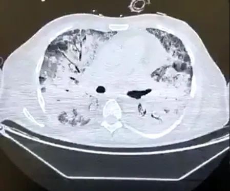 Koronavirüs işte böyle yayılıyor! Bunu daha önce hiç görmediniz!-4