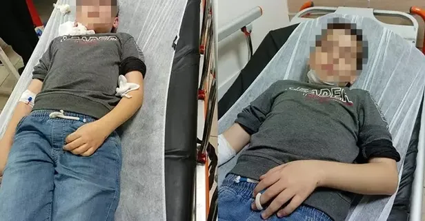 Sokak köpeklerinin saldırısından kaçan küçük çocuk demir korkuluklardan atlarken boynundan yaralandı