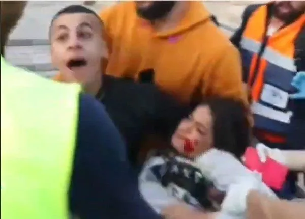 kuduste-vahset-3-israil-polisi-filistinli-bir-kiza-vahsice-saldirdi-1646158423502.jpeg Kudüs'te vahşet! 3 İsrail polisi Filistinli bir kıza vahşice saldırdı-3