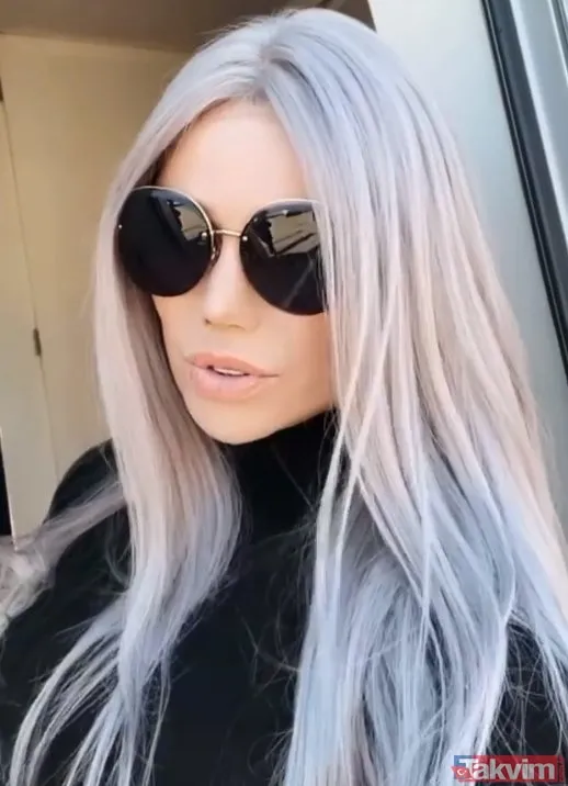 Şarkıcı Lara sonunda küçülttü! Estetikle bambaşka biri olan Lara paylaştı görenler 'yok artık' dedi - 25