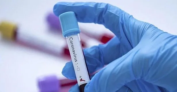 Bilim insanları COVİD-19 hastalarının bağışıklığını araştırdı: Antikor korumuyor