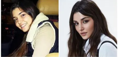 Hande Erçel'in estetiksiz hali harıl harıl doktor arattırıyor çok yaşa plastik cerrahi! Hande parayı bulunca yüzü değiştirmiş-4