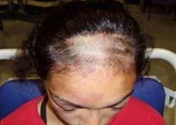 Türk kızına ırkçı saldırı