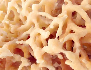Kemik erimesi (osteoporoz) en çok kadınları tehdit ediyor! Özellikle çok kahve kullananlar...