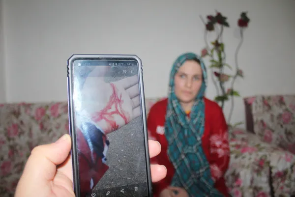 dun-esinden-siddet-gordugunu-soylemisti-bugun-cesedini-teshis-etti-1610706763083.jpg Dün eşinden şiddet gördüğünü söylemişti! Bugün cesedini teşhis etti-3