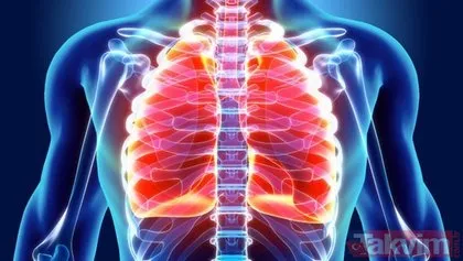 Akciğer kanseri nedir? Akciğer kanserinin nedenleri ve belirtileri nelerdir?