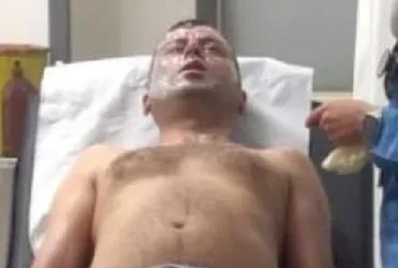 Lavabo açıcı bomba gibi patladı! Yüzünden yaralandı