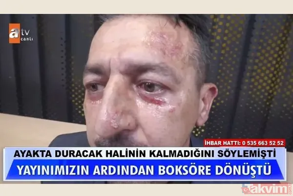 Müge Anlı'daki üfürükçünün skandalları bitmiyor! Stüdyoda hasta rolü yapıp yayın sonrası kabadayı kesildi - 9