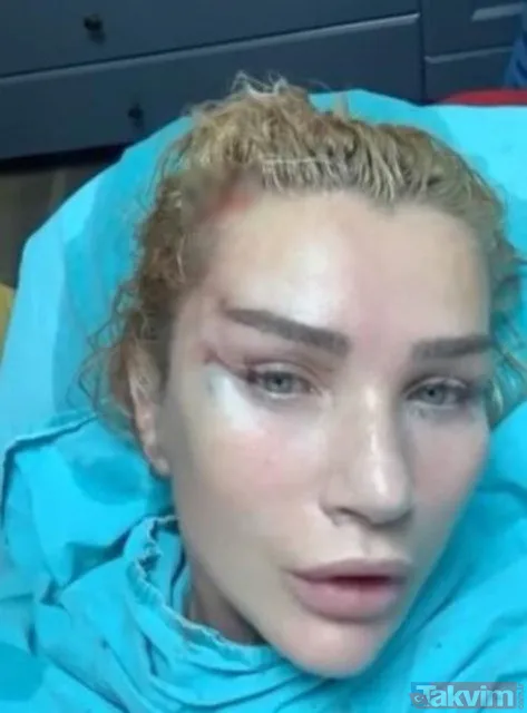 Seda Sayan ne var ne yok itiraf etti! “Adliye koridoru birbirine girdi” Boşanma iddiasına yanıt! 2 sene önce Çağlar Ökten ile evlenmişti... - 4