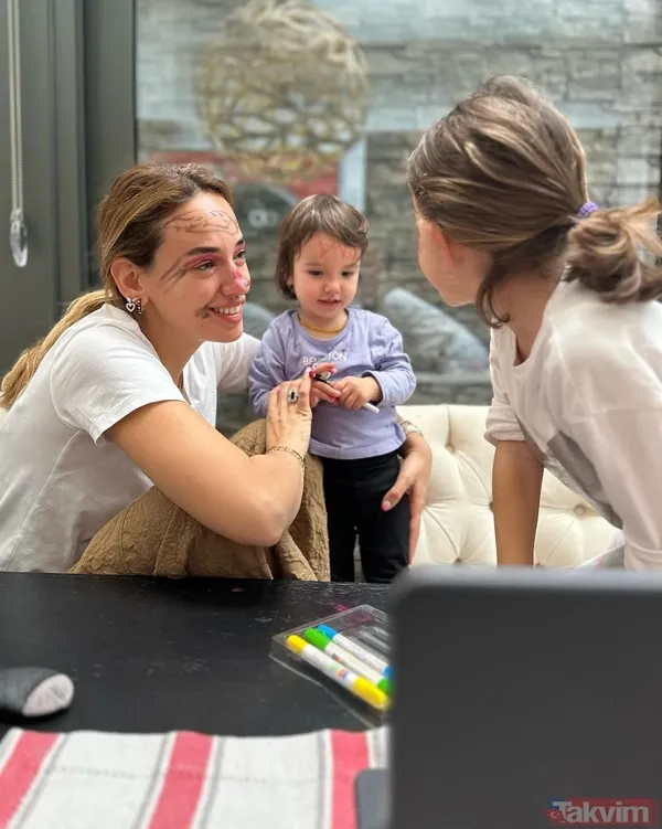 15 günde 7 kilo verdi! Eser Yenenler’in son haline bakın! Eşi Berfu Yenenlerle duyurdu! 15 günlük farkı gözler önüne serdi... - 27