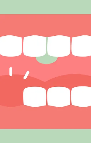 Rüyada diş çıktığını görmek ne anlama gelir?