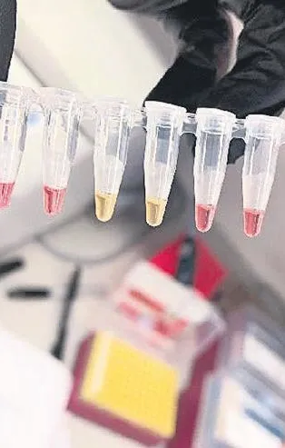 30 dakikada tanı imkanı