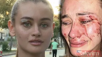 Çeşme’de dövüldüğünü iddia edilen Ukraynalı Model Daria Kyryliuk savcılıkta ifade verdi! Tüm söyledikleri yalan