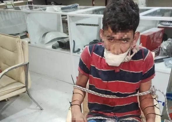 Antalya'da korkunç patron işkencesi! Kerpetenle dişlerini söküp böcek yedirdiler! Darp raporu almasın diye...-9