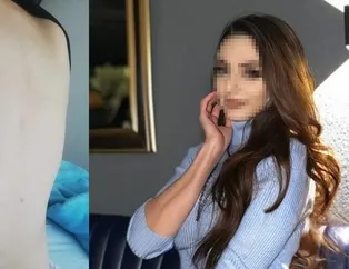 Rezidanstaki işkence olayında flaş gelişme