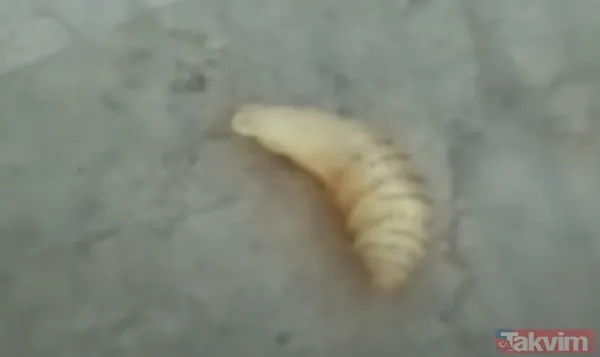 Karnındaki şişlik için gitti içinden çıkan doktorları bile şoke etti! Yer uzak değil Kayseri! 64 kilo girdi 55 kilo çıktı - 50