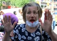 CHPli Ekrem İmamoğlunu protestoda kolu kırılan Ayşe Topçu konuştu: Bu parkı vermeyiz