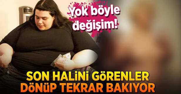 300 kiloya ulaşmıştı! Son hali şaşırttı