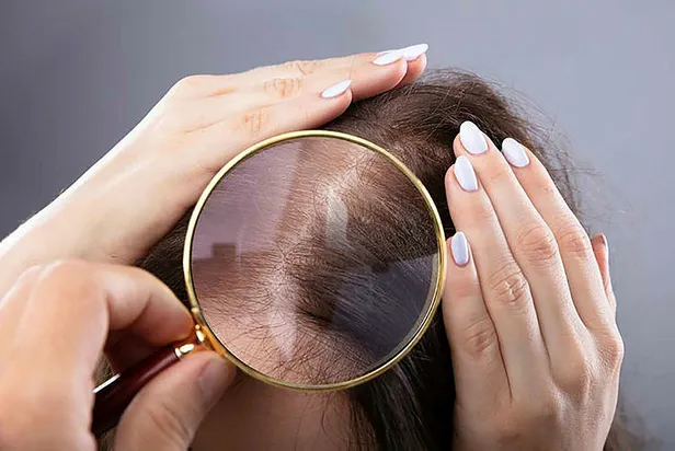 kepek-sorununu-maziye-gomeceksiniz-egzamadan-iz-birakmiyor-28-dakikada-sac-koklerini-neme-boguyor-1694503204806.jpg Kepek sorununu maziye gömeceksiniz! Egzamadan iz bırakmıyor, 28 dakikada saç köklerini neme boğuyor!-4