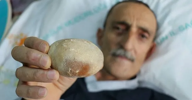 Samsun’da doktorları şoke eden olay: Görünce patates sandım