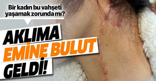 Antalya'da eski eş vahşetinden kurtulan Oya Aydoğdu: Aklıma Emine Bulut geldi