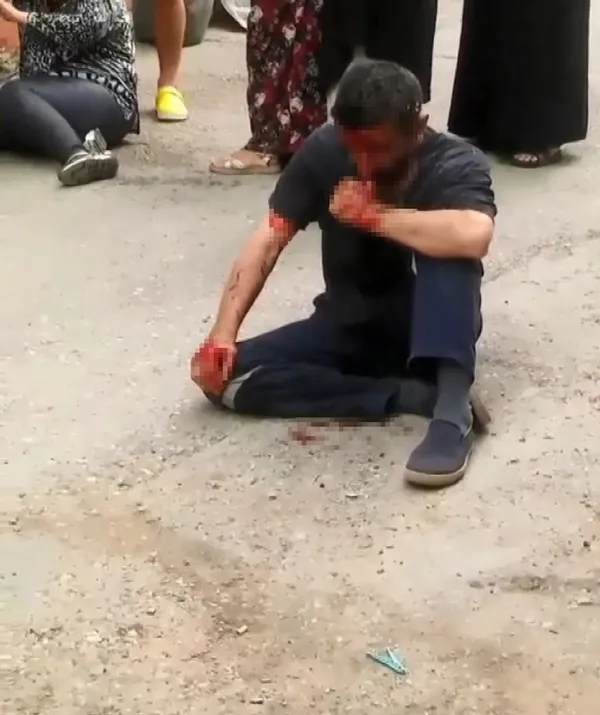 5-yasindaki-kiz-cocugunu-taciz-etmeye-calisan-sapik-mahalleli-tarafindan-linc-edildi-1625566699350.jpg 5 yaşındaki kız çocuğunu taciz etmeye çalışan sapık mahalleli tarafından linç edildi! Baba hadım edilmesini istedi-8