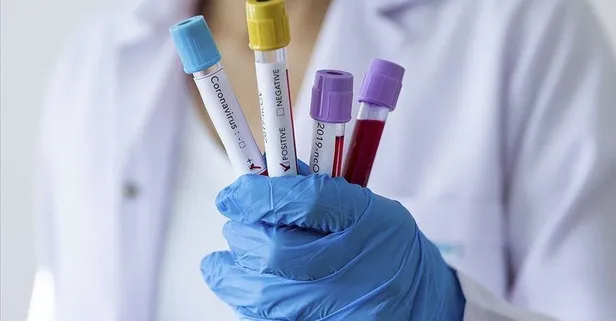 Son dakika: 24 Mayıs 2022 koronavirüs vaka ve vefat sayıları belli oldu