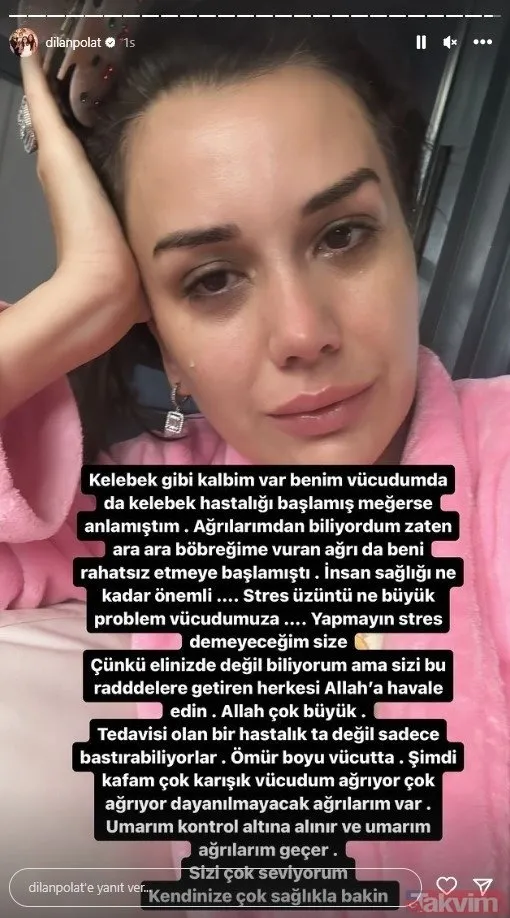 son-dakika-dilan-polat-hastaligini-acikladi-dilan-polat-ne-hastasi-lupus-hastaligi-nedir-neden-olur-kelebek-ha-1696362556959.jpg Dilan Polat ne hastası? Lupus hastalığı nedir, neden olur? Kelebek hastalığı belirtileri ve tedavisi...-4