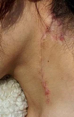 Antalya'da eski eş vahşetinden kurtulan Oya Aydoğdu: Aklıma Emine Bulut geldi