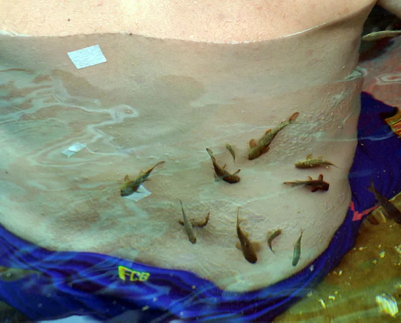 ’Doktor balıklar’ tehlike altında!