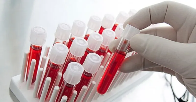 en-uzun-omurlu-kan-grubu-belli-oldu-70-yasina-kadar-hastalik-yuzu-gormuyorlar-1718890103624.jpg En uzun ömürlü kan grubu belli oldu! 70 yaşına kadar hastalık yüzü görmüyorlar-6