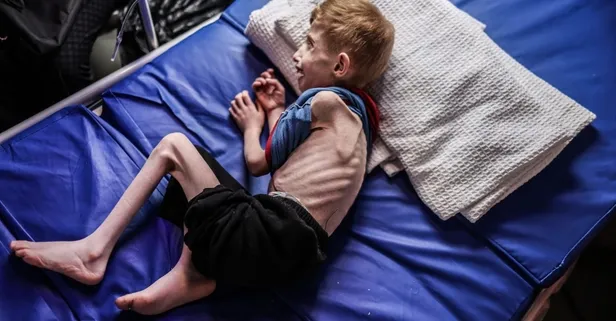 Gazze'de hastaneler abluka altında! 6 yaşındaki Fadi ez-Zenat da ölümün pençesinde